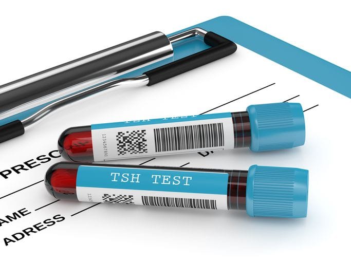 Conteúdo Médico: Alterações do TSH em indivíduos saudáveis com hipotiroidismo