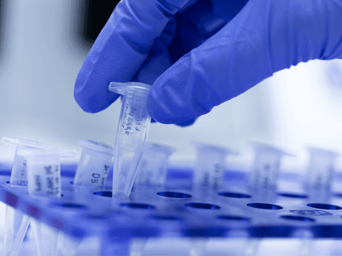 Conteúdo Médico: Diagnóstico molecular de infecções sexualmente transmissíveis