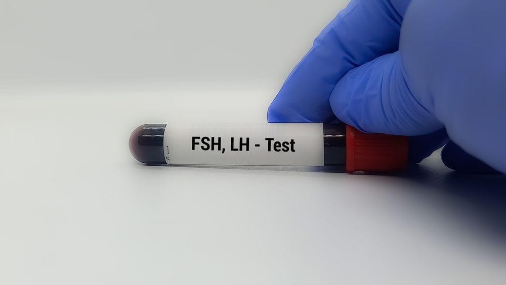 Entenda como funciona o exame de Hormônio Folículo-Estimulante (FSH)